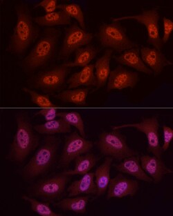 Invitrogen WTAP Polyclonal Antibody 100 &mu;L; Unconjugated:Antibodies,
