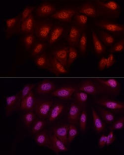 Invitrogen WTAP Polyclonal Antibody 100 &mu;L; Unconjugated:Antibodies,
