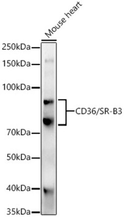 Invitrogen CD36 Polyclonal Antibody 100 &mu;L; Unconjugated:Antibodies,