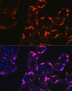 Invitrogen S100P Polyclonal Antibody 100 &mu;L; Unconjugated:Antibodies,