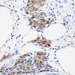 Invitrogen S100P Polyclonal Antibody 100 &mu;L; Unconjugated:Antibodies,