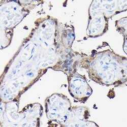 Invitrogen S100P Polyclonal Antibody 100 &mu;L; Unconjugated:Antibodies,