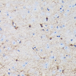 Invitrogen S100P Polyclonal Antibody 100 &mu;L; Unconjugated:Antibodies,