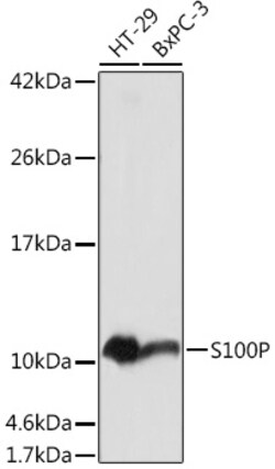Invitrogen S100P Polyclonal Antibody 100 &mu;L; Unconjugated:Antibodies,