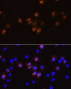 SWAP70 Polyclonal Antibody:Antibodies, Polyclonal