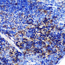SWAP70 Polyclonal Antibody:Antibodies, Polyclonal