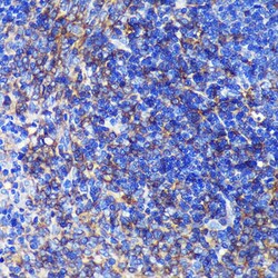 SWAP70 Polyclonal Antibody:Antibodies, Polyclonal