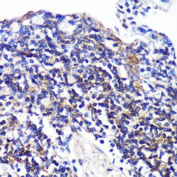 SWAP70 Polyclonal Antibody:Antibodies, Polyclonal