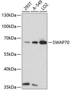 SWAP70 Polyclonal Antibody:Antibodies, Polyclonal