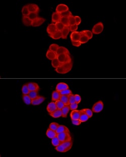 Invitrogen PABP Polyclonal Antibody 100 &mu;L; Unconjugated:Antibodies,