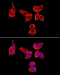 Invitrogen PABP Polyclonal Antibody 100 &mu;L; Unconjugated:Antibodies,