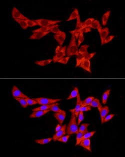 Invitrogen PABP Polyclonal Antibody 100 &mu;L; Unconjugated:Antibodies,