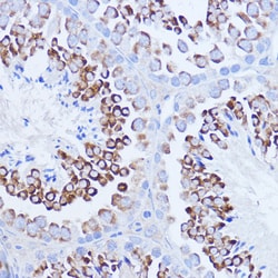 Invitrogen PABP Polyclonal Antibody 100 &mu;L; Unconjugated:Antibodies,