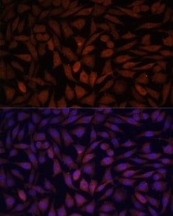 KLHL8 Polyclonal Antibody 100 &mu;L | Buy Online | Thermo Scientific | Fisher Scientific