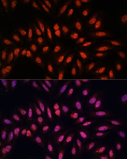 KLHL8 Polyclonal Antibody 100 &mu;L | Buy Online | Thermo Scientific | Fisher Scientific