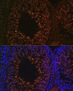 Invitrogen LDHAL6B Polyclonal Antibody 100 &mu;L; Unconjugated:Antibodies,