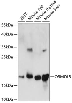Invitrogen ORMDL3 Polyclonal Antibody 100 &mu;L; Unconjugated:Antibodies,