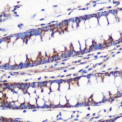 Invitrogen MRPL54 Polyclonal Antibody 100 &mu;L; Unconjugated:Antibodies,
