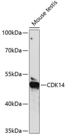 Invitrogen PFTK1 Polyclonal Antibody 100 &mu;L; Unconjugated:Antibodies,