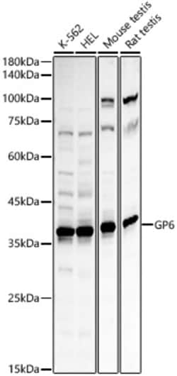Invitrogen GP6 Polyclonal Antibody 100 &mu;L; Unconjugated:Antibodies,