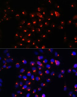 Invitrogen SGMS1 Polyclonal Antibody 100 &mu;L; Unconjugated:Antibodies,