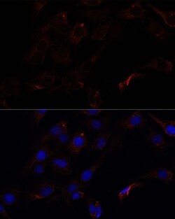 Invitrogen Septin-8 Polyclonal Antibody 100 &mu;L; Unconjugated:Antibodies,