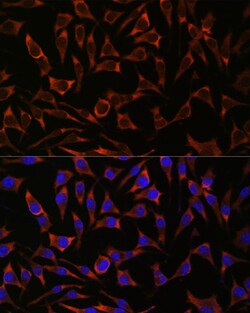 Invitrogen Septin-8 Polyclonal Antibody 100 &mu;L; Unconjugated:Antibodies,
