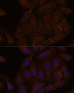 Invitrogen Septin-8 Polyclonal Antibody 100 &mu;L; Unconjugated:Antibodies,
