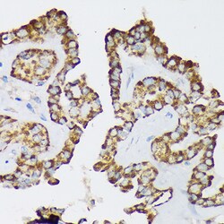 Invitrogen Septin-8 Polyclonal Antibody 100 &mu;L; Unconjugated:Antibodies,