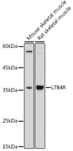 Invitrogen LTB4R Polyclonal Antibody 100 &mu;L | Buy Online | Invitrogen&trade; | Fisher Scientific