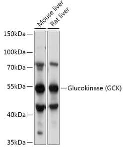 Invitrogen GCK Polyclonal Antibody 100 &mu;L; Unconjugated:Antibodies,