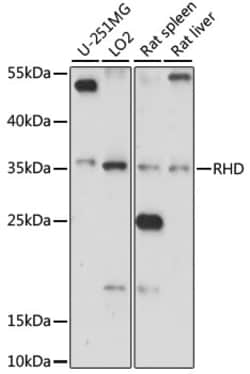 RHD Polyclonal Antibody:Antibodies, Polyclonal