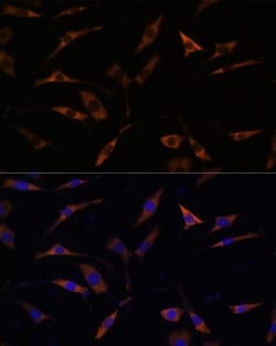 Invitrogen RPL28 Polyclonal Antibody 100 &mu;L; Unconjugated:Antibodies,