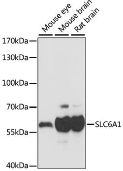 Invitrogen GAT-1 Polyclonal Antibody 100 &mu;L | Buy Online | Invitrogen&trade; | Fisher Scientific