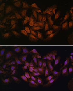 Invitrogen ZNF9 Polyclonal Antibody 100 &mu;L; Unconjugated:Antibodies,