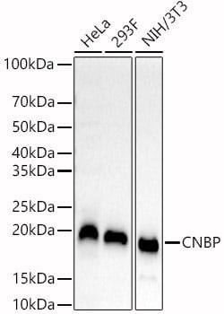 Invitrogen ZNF9 Polyclonal Antibody 100 &mu;L; Unconjugated:Antibodies,