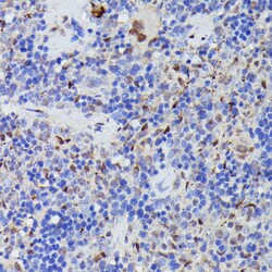 Invitrogen Cdc23 Polyclonal Antibody 100 &mu;L; Unconjugated:Antibodies,