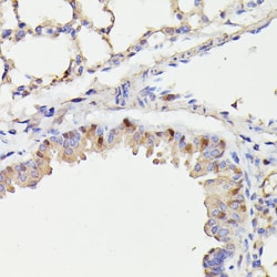 Invitrogen Cdc23 Polyclonal Antibody 100 &mu;L; Unconjugated:Antibodies,