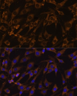eIF5B Polyclonal Antibody:Antibodies, Polyclonal