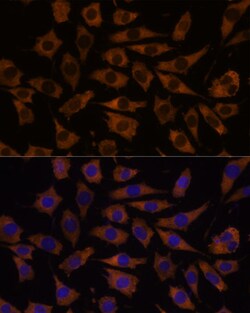 eIF5B Polyclonal Antibody:Antibodies, Polyclonal