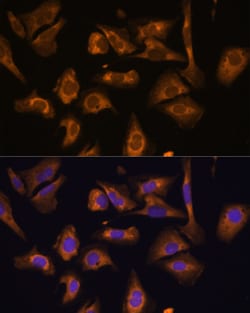 eIF5B Polyclonal Antibody:Antibodies, Polyclonal