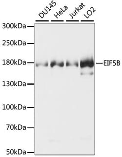 eIF5B Polyclonal Antibody:Antibodies, Polyclonal