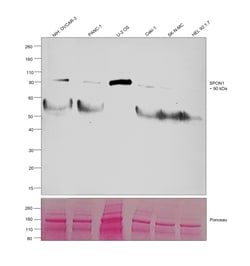 Invitrogen SPON1 Polyclonal Antibody 100 &mu;L; Unconjugated:Antibodies,