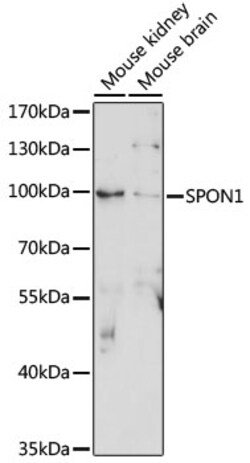 Invitrogen SPON1 Polyclonal Antibody 100 &mu;L; Unconjugated:Antibodies,