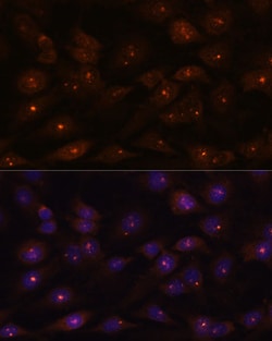 RNAse H2A Polyclonal Antibody:Antibodies, Polyclonal