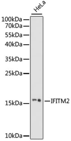 Invitrogen IFITM2 Polyclonal Antibody 100 &mu;L; Unconjugated:Antibodies,