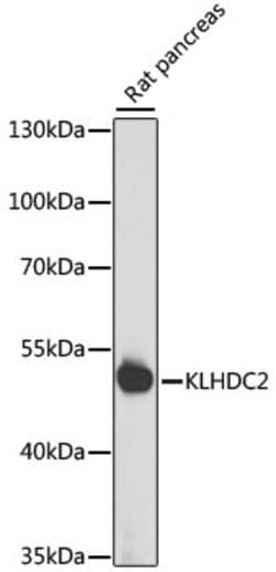 KLHDC2 Polyclonal Antibody, Invitrogen 100 &mu;L; Unconjugated:Antibodies,