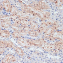 Invitrogen Claudin 17 Polyclonal Antibody 100 &mu;L; Unconjugated:Antibodies,
