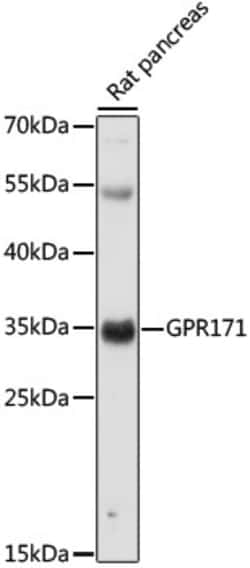 Invitrogen GPR171 Polyclonal Antibody 100 &mu;L | Buy Online | Invitrogen&trade; | Fisher Scientific