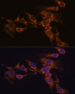 Invitrogen PYCR2 Polyclonal Antibody 100 μL; Unconjugated:Antibodies,